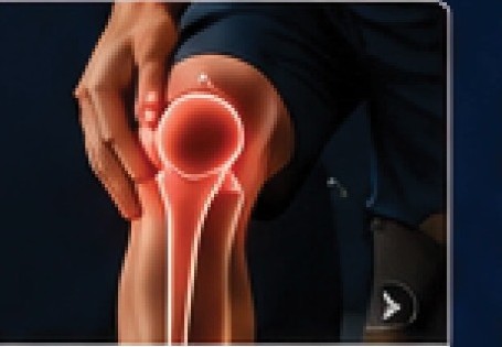 Top 10 Injuries in Pickleball